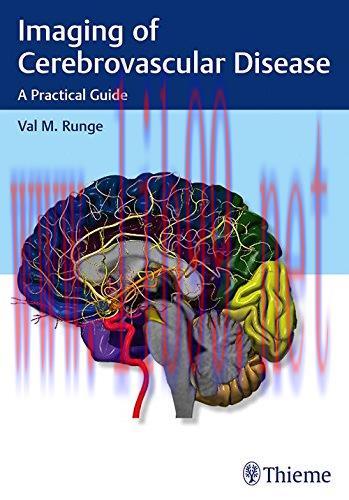 [AME]Imaging of Cerebrovascular Disease: A Practical Guide (ORIGINAL PDF from_ Publisher)
