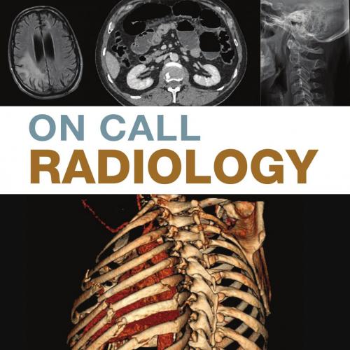 On Call Radiology