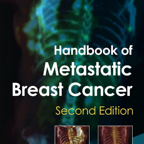 Handbook of Metastatic Breast Cancer,2nd Edition