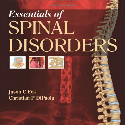 Essentials of Spinal Disorders