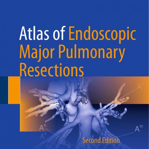 Atlas of Endoscopic Major Pulmonary Resections 2nd Edition - Wei Zhi