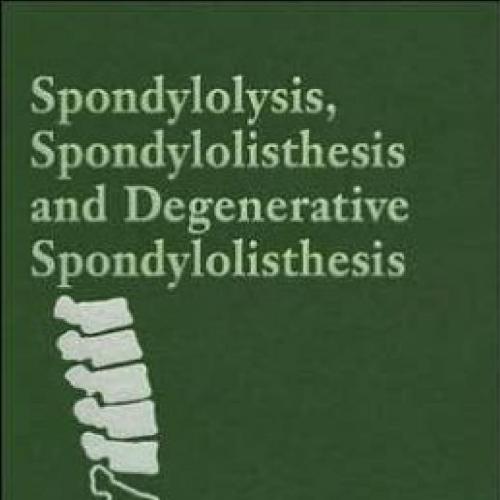 Spondylolysis, Spondylolisthesis, and Degenerative Spondylolisthesis - Gunzburg, Robert(Author)