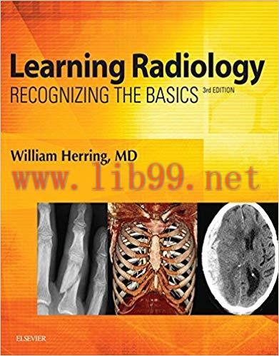 (PDF)Learning Radiology E-Book: Recognizing the Basics 3rd Edition