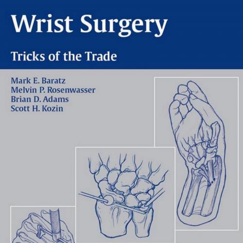 Wrist Surgery Trick of the Trade - Wei Zhi