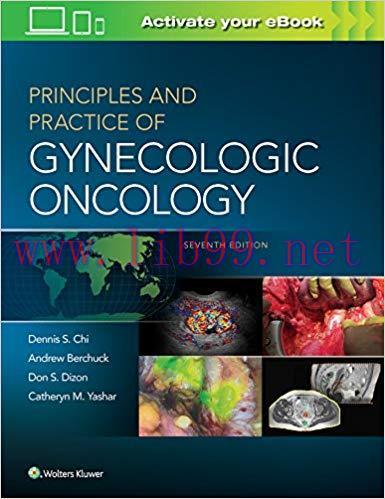 [EPUB]Principles and Practice of Gynecologic Oncology, 7th Edition