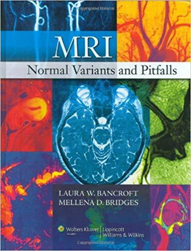 MRI Normal Variants and Pitfalls, 1st Edition