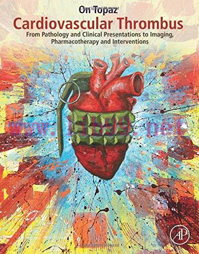 [AME]Cardiovascular Thrombus: From_ Pathology and Clinical Presentations to Imaging, Pharmacoth...