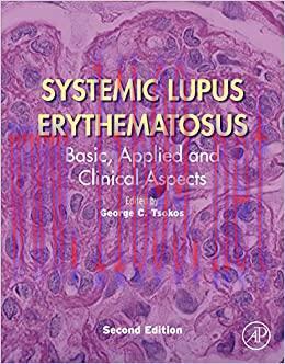 (PDF)Systemic Lupus Erythematosus: Basic, Applied and Clinical Aspects