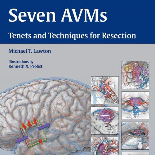 Seven AVMs Tenets and Techniques for Resection - Lawton, Michael T_
