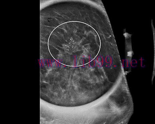 [AME]MRIOnline Imaging Mastery Series: High Risk Screening Breast MRI 2021 (CME VIDEOS)