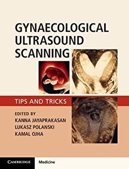 Gynaecological Ultrasound Scanning Tips and Tricks