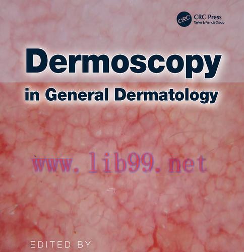 [PDF]Dermoscopy in General Dermatology