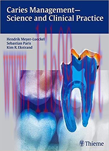 [PDF]Caries Management - Science and Clinical Practice