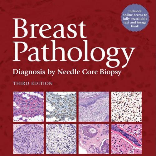 Breast Pathology-Diagnosis by Needle Core Biopsy, 3rd Edition