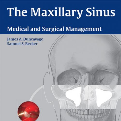 Maxillary Sinus Medical and Surgical Management, The
