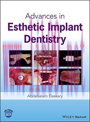 [AME]Advances in Esthetic Implant Dentistry