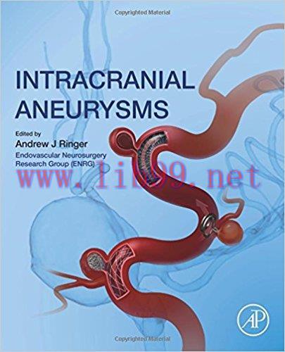 [AME]Intracranial Aneurysms 1st Edition (PDF)