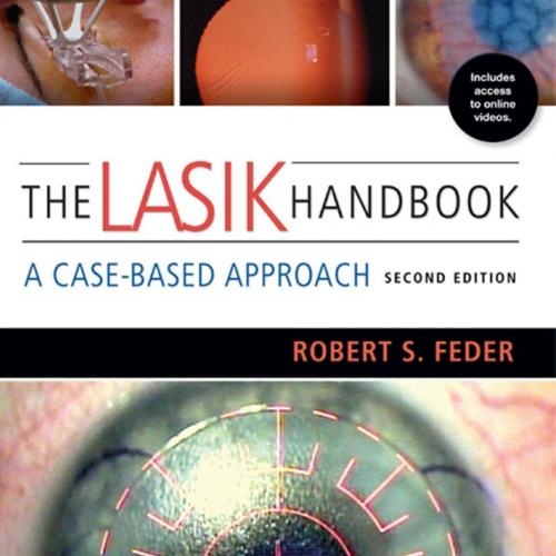 LASIK Handbook A Case-Based Approach 2nd Ediiton,2013, The - HP