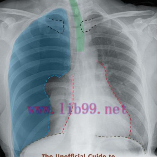 [AME]The Unofficial Guide to Radiology: 100 Practice Chest X Rays with Full Colour Annotations ...