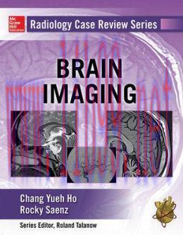 [AME]Radiology Case Review Series: Brain Imaging (ORIGINAL PDF from_ Publisher)