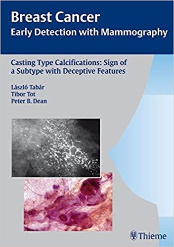 Casting Type Calcifications (Rare)