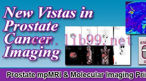 [AME]New Vistas in Prostate Cancer Imaging 2022 (CME VIDEOS)