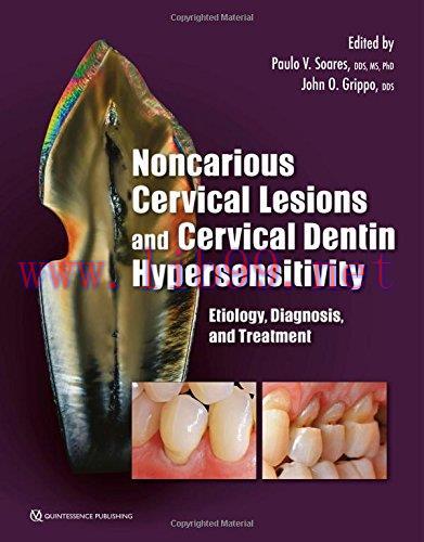 [AME]Noncarious Cervical Lesions and Cervical Dentin Hypersensitivity: Etiology, Diagnosis, and...