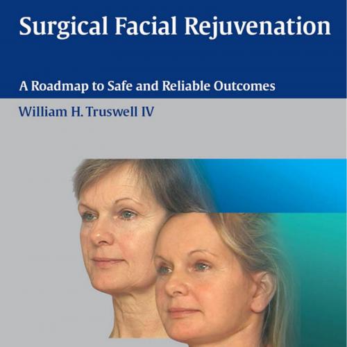 Surgical Facial Rejuvenation A Roadmap to Safe and Reliable Outcomes