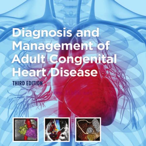 [AME]Diagnosis and Management of Adult Congenital Heart Disease, 3rd Edition (PDF)