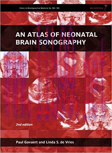 (PDF)An Atlas of Neonatal Brain Sonography, 2nd Edition (182) 2nd Edition
