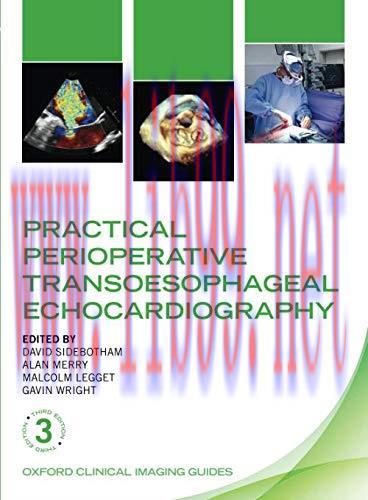 [AME]Practical Perioperative Transoesophageal Echocardiography (Oxford Clinical Imaging Guides)...