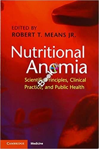 Nutritional Anemia
