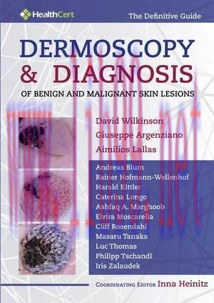 [AME]Dermoscopy and Diagnosis of Benign and Malignant Skin Lesions (ePub)