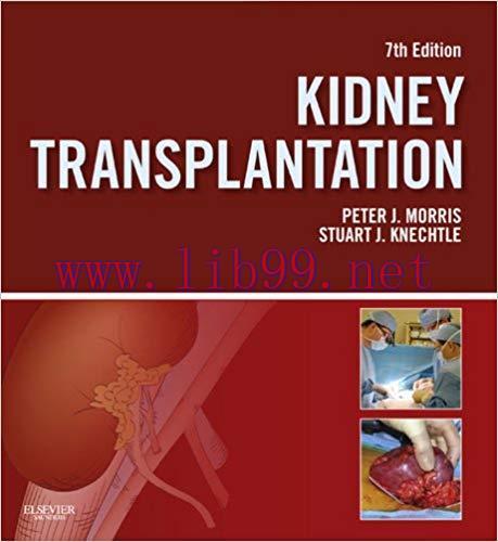 (PDF)Kidney Transplantation &ndash; Principles and Practice E-Book (Morris,Kidney Transplantation) 7t...