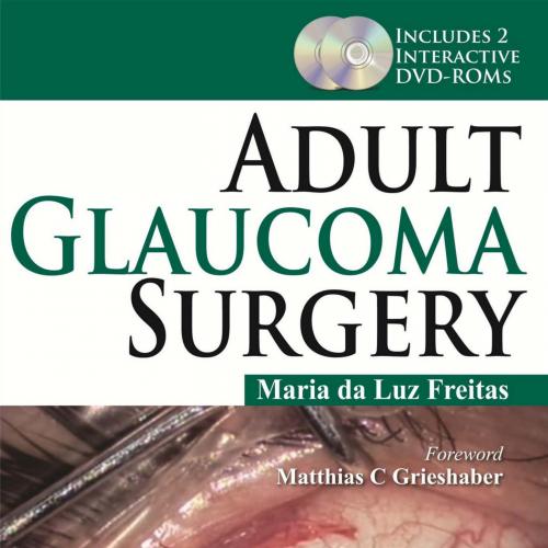 Adult Glaucoma Surgery