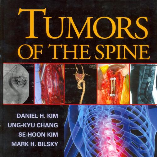 Tumors of the Spine