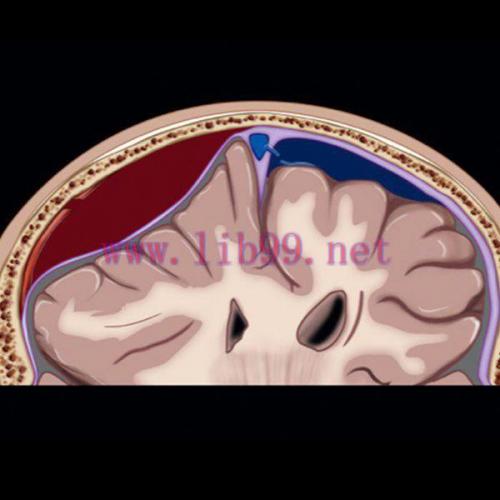 [AME]MRIOnline Emergency Series: Emergency Neuroimaging: Brain 2021 (CME VIDEOS)