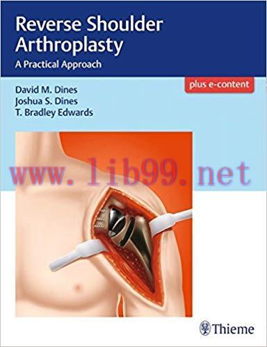 [PDF]Reverse Shoulder Arthroplasty: A Practical Approach + Videos