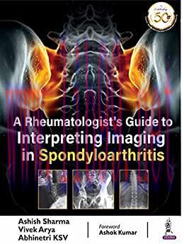 [PDF]A Rheumatologist’S Guide To Interpreting Imaging In Spondyloarthritis
