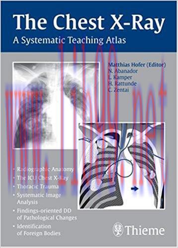 [PDF]The Chest X-Ray - A Systematic Teaching Atlas, 1e [Thieme] [2007]