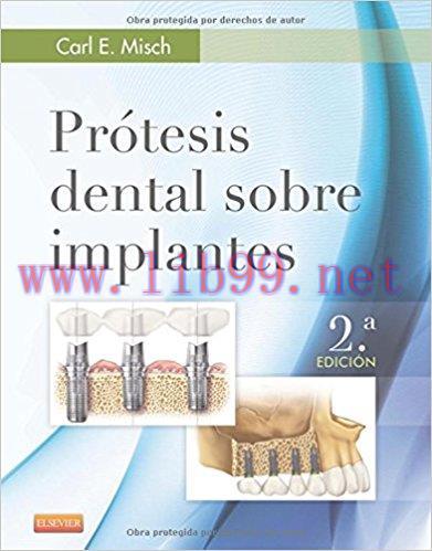 [AME]Pr&oacute;tesis dental sobre implantes (Spanish Edition), 2e (PDF)