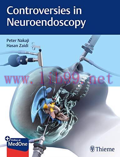 [AME]Controversies in Neuroendoscopy (Original PDF)