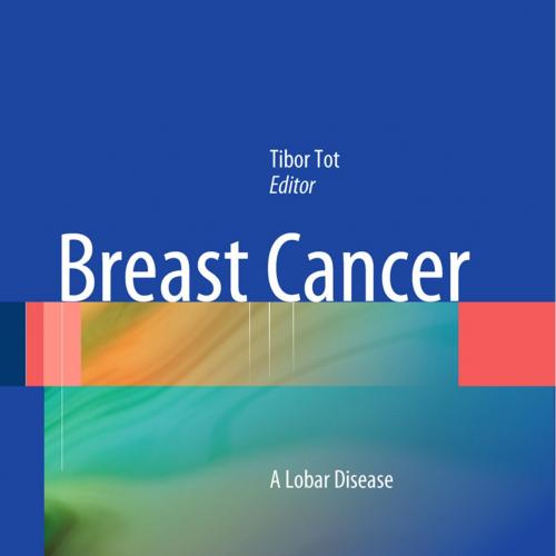 Breast Cancer_ A Lobar Disease