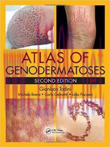 [AME]Atlas of Genodermatoses, Second Edition