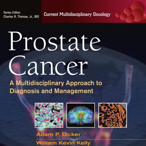 Prostate Cancer A Multidisciplinary Approach to Diagnosis and Management