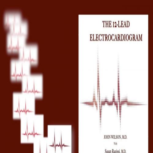 12-Lead Electrocardiogram, The