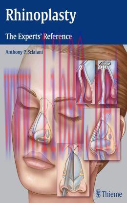 [AME]Rhinoplasty: The Experts' Reference