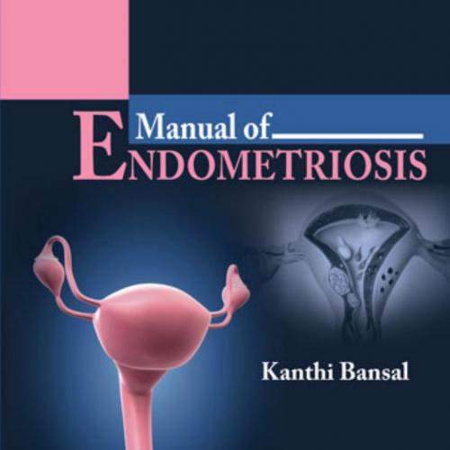 Manual of Endometriosis - Wei Zhi