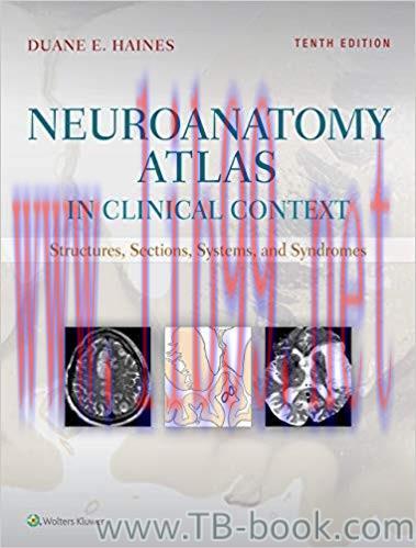 Neuroanatomy Atlas in Clinical Context: Structures, Sections, Systems, and Syndromes 10th Editi...