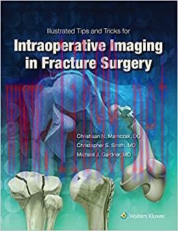 (PDF)Illustrated Tips and Tricks for Intraoperative Imaging in Fracture Surgery First Edition
